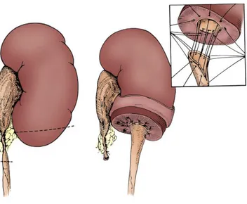 Fig. 16 Completamento dell' anastomosi   