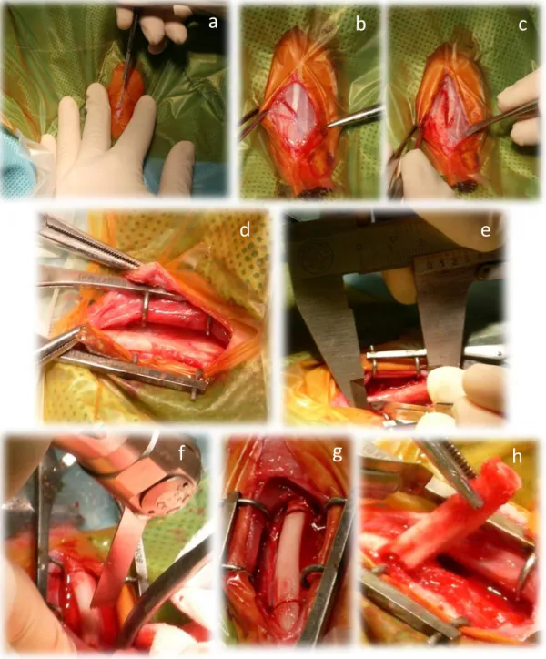 Figura IV.11 – Immagini intervento chirurgico. a-c) dissezione dei tessuti molli, d) dissezione del  periostio, e) Misurazione con calibro centesimale della distanza delle 2 incisioni bicorticali, f) osteotomia 