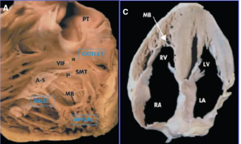 Fig 1. A. The inlet, trabeculated apical myocardium and infundibulum of RV. C. The 4- 4-chamber  anaomic  plane