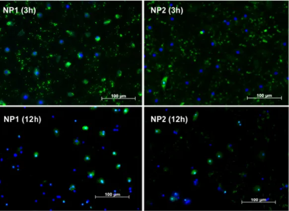 Figura 3: Immagini acquisite per mezzo di un microscopio a fluorescenza che mostra- mostra-no l’internalizzazione di namostra-noparticelle N + –rCh(60 ◦ )-SH/rHA (NP1) o N + –rCh(50 ◦  )-SH/rHA (NP2) marcate con FITC da parte delle cellule progenitrici end