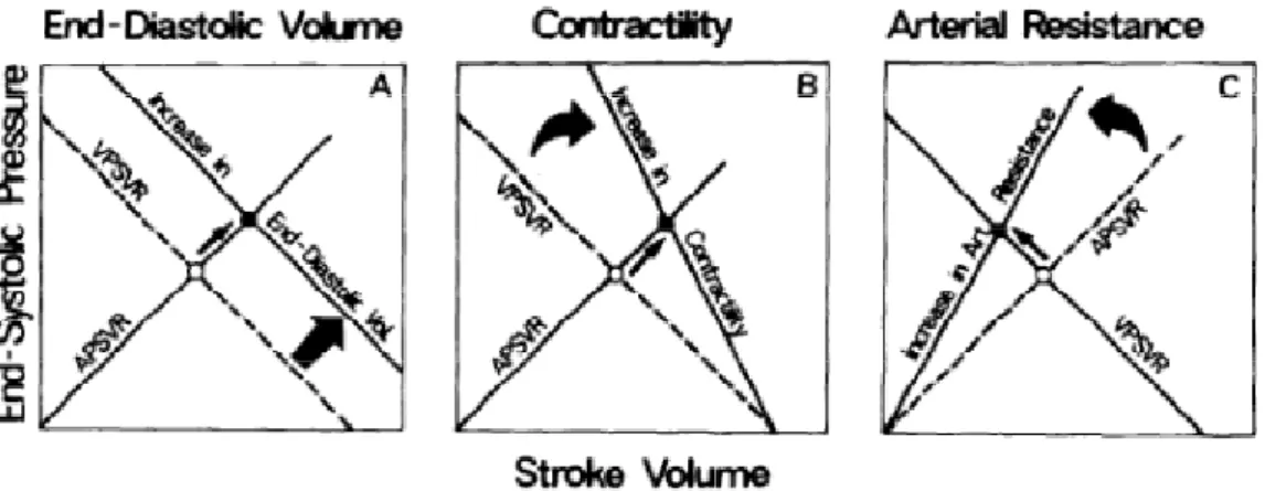 Figura A eEffetto della modificazione del precarico sullo stroke volume. L’aumento dello stroke determinato  dall’aumento dell’End Diastolic volume non modifica la slope dell’Elastanza Ventricolare (Es)che risulta quindi  indipendente dal precarico