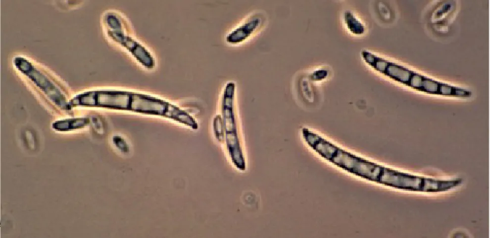 Fig. 3 Macro e microconidi di   F. oxysporum.