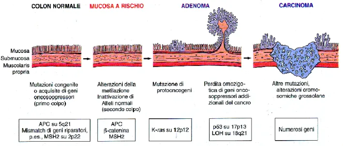Figura 2.Sequenza adenoma-carcinoma  