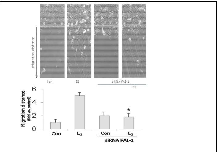 Figure  6.  HUVECs  were  transfected  with  siRNAs  against  PAI-1  for  48  hours.  Endothelial  cells  were  scraped  from  the  culture  dish  and  then  treated  with  1nM  E2