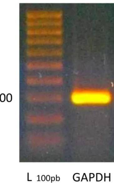 Figura  17.  Elettroforesi  su  gel  di  agarosio  per  il  prodotto  di  PCR  con  primer  relativi  alla  GAPDH su cellule A375 