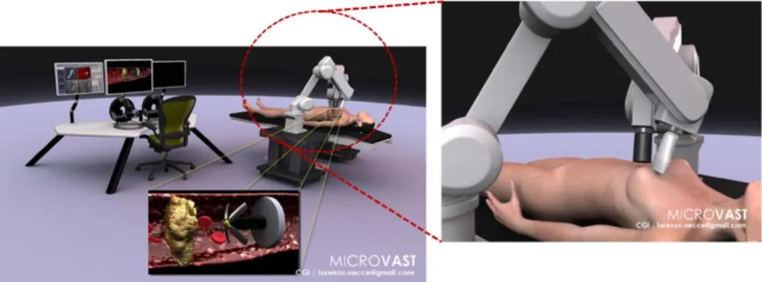 Figura 2.2: Rappresentazione grafica della piattaforma endovascolare MicroVAST