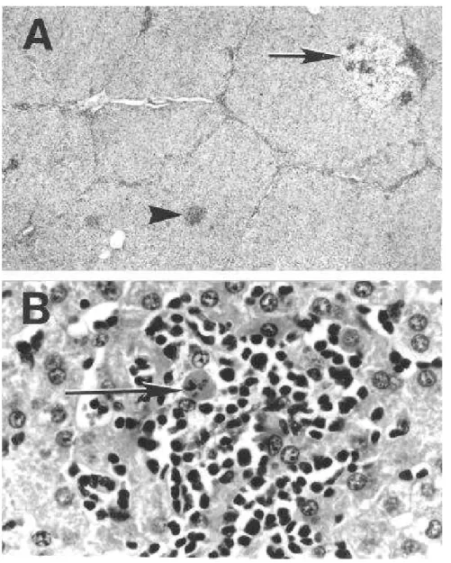 Figura 6: Lesioni istopatologiche in fegati di suino (da Meng et al., 1997)  A: Epatite linfoplasmocitaria multifocale (x10)