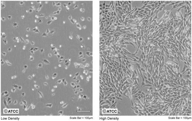 Figura 11. Fotomicrografica delle cellule A375 a bassa densità (sinistra) ed alta densità (destra) di crescita