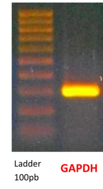Figura 14.Elettroforesi su gel di agarosio per il prodotto di PCR con primer relativi alla GAPDH