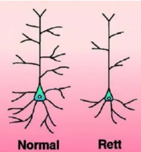 Figure 10: Schematic representation of pyramidal neurons from control and  Rett brains