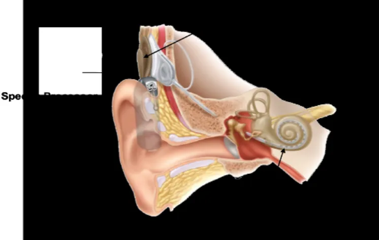 Figure 9: External component for children of the cochlear implant.
