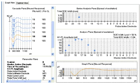 Figure 27: SOE width measurement with Custom Sound Software.
