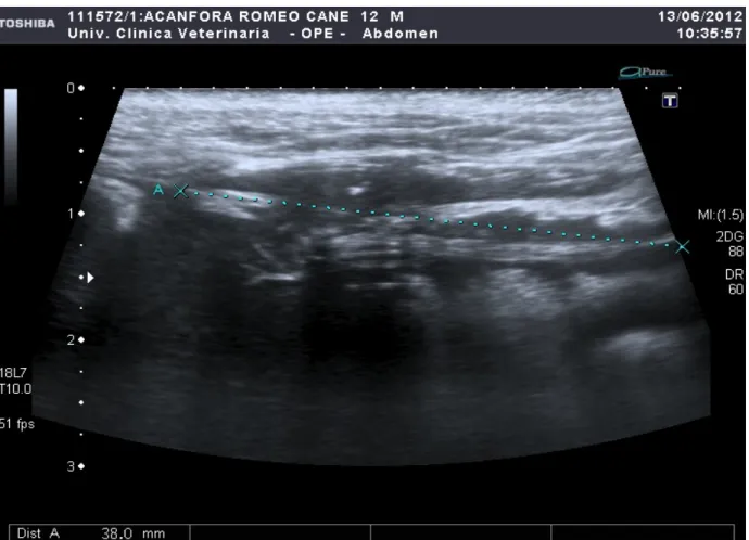 Fig. 3: L'immagine del c.e. visualizzato a livello pancreatico. 