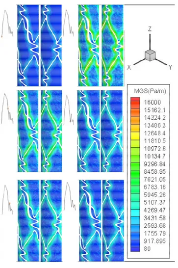 Figure 10 – MGS in unsteady state for S2 stent on the left and S1 one on the right. 