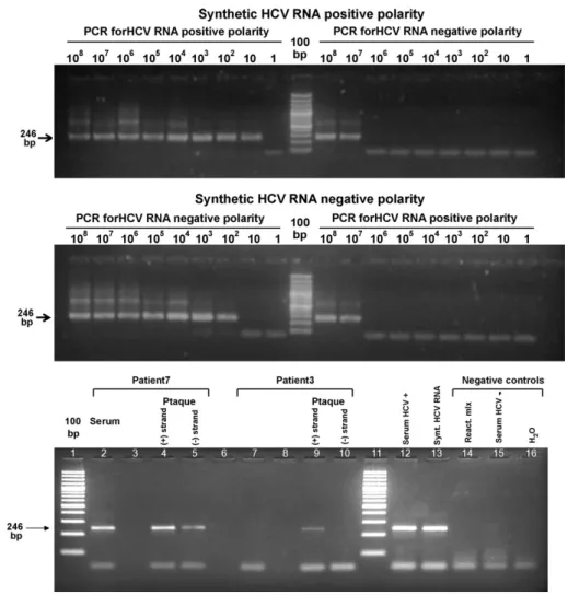 Fig. 1. (Panel A) Analysis of sensitivity and speciﬁcity of HCV strand-speciﬁc nested RT-PCR