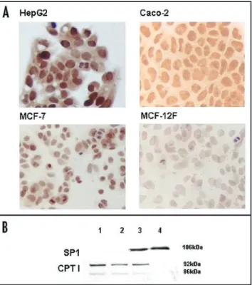 Figure  3.  CPT1A  protein  expression  in  no  cancerous  (MCF‑12F)  and   cancerous  (HepG2,  Caco‑2,  MCF‑7)  cells,  by  ICC  (A)  and  Western  blot  analysis (B)