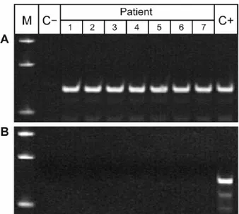 Figure 4: Semi-nested PCR performed on aliquots of urine DNA isolated from seven TB  infected patients (Lanes 3-9) with primers designed for short 129/67 (A) and large 330/69 (B)  amplicons (see Materials and methods)