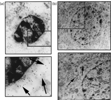 Fig. 4 Ultrastructural evidence of apoptosis caused by the HIV-1 coat glycoprotein gp120 in a rat brain neocortical cell immunopositive for the neuro®lament, cytoskeletal, proteins and typical neuronal markers