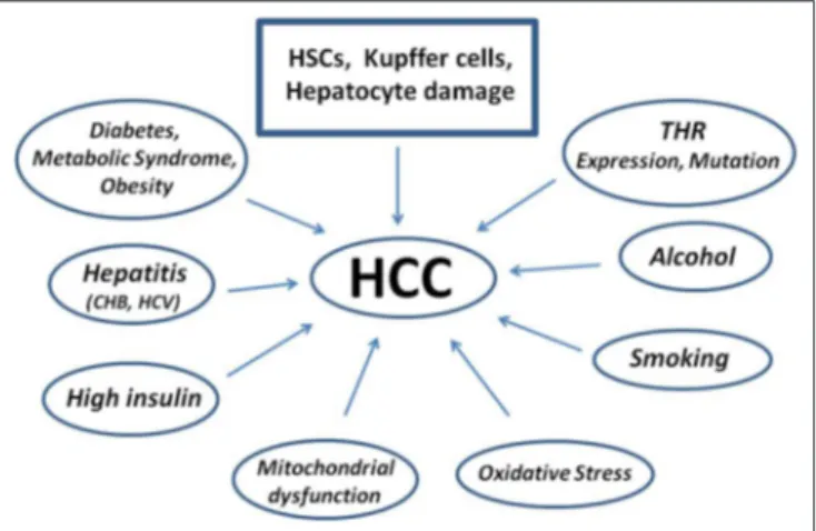 FIGURE 3 | Scheme showing diseases and factors leading to the pathogenesis of Human Hepatocellular Carcinoma starting from Hepatic Stellate Cells damage