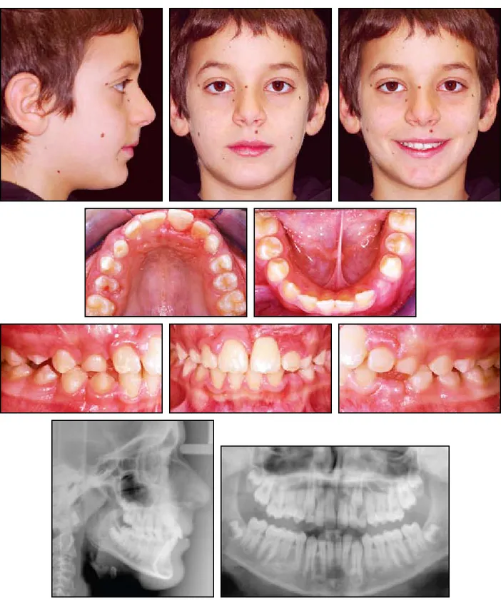 Fig. 7  Patient after 12 months of treatment.