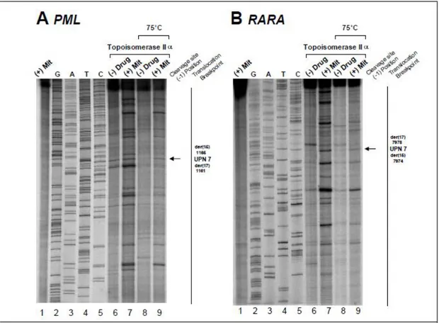 Figure  S3:  Investigation  of  t(15;17)  translocation  mechanism  in  UPN  7  by  in  vitro  topoisomerase  IIα  DNA  cleavage  assay