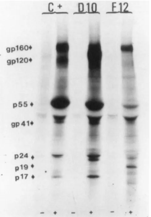 FIG. 1. Radioimmunoprecipitation of [35S]cysteine-labeled cellular lysates of HTLV-IIIB-infected HUT-78 cells