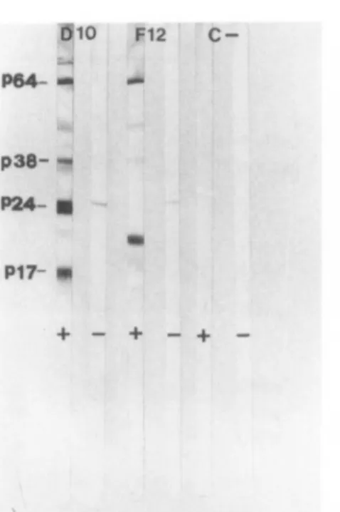 FIG. 2. Western blot analysis of uninfected HUT-78 (C