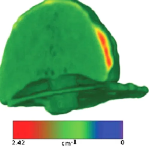 Figure 6. Tomographic reconstruction of sample 8; the inclusion with high attenuation coefficient on the edge is clearly visible.