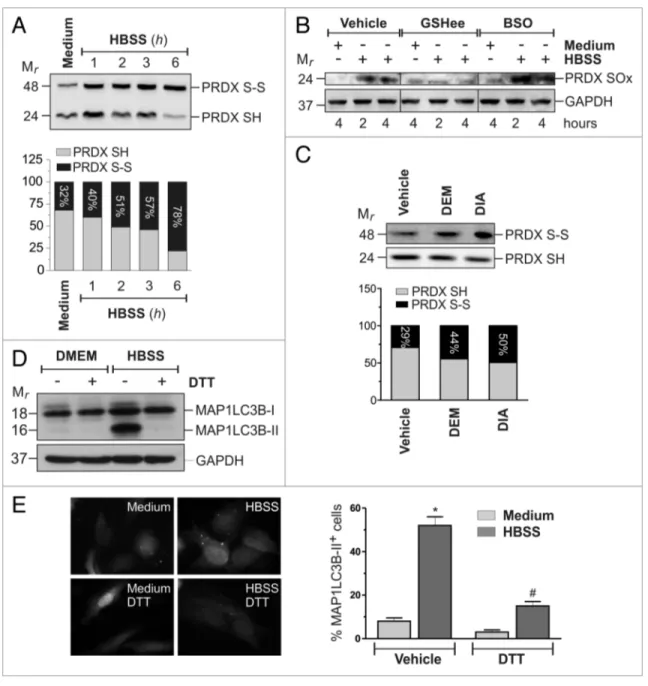 Figure 6. Redox changes of cellular thiol pool impact on starvation-induced autophagy