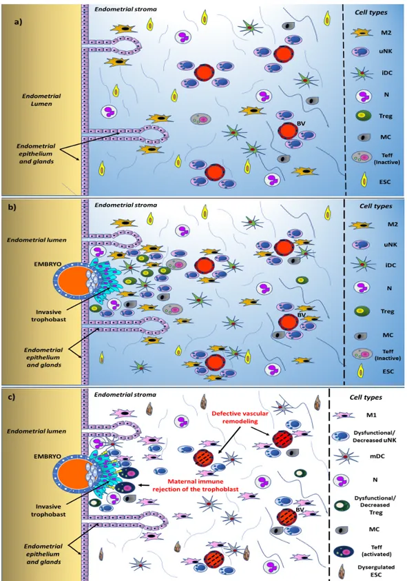 Figure 1. Schematic representation of the changes occurring in the human endometrium and in local  immune cell trafficking in the normal state and in recurrent pregnancy loss (RPL)