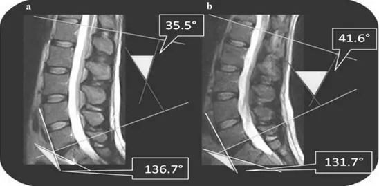 Fig. 1 Fast spin echo (FSE) T2-weighted magnetic resonance images (MRI) in the sagittal plane