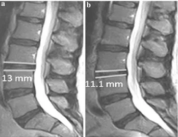 Fig. 3 Fast spin echo (FSE) T2-weighted magnetic resonance images (MRI) in the sagittal plane