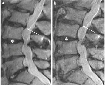 Fig. 9 Fast spin echo (FSE) T2-weighted magnetic resonance images (MRI) in the sagittal and axial planes