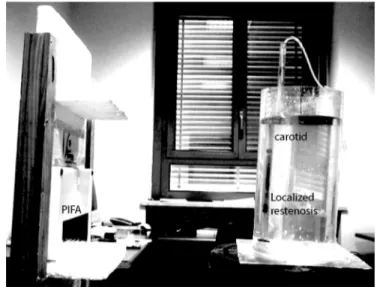 Fig. 8. STENTag prototype with a details of the integration of RFID IC and of the inductor.