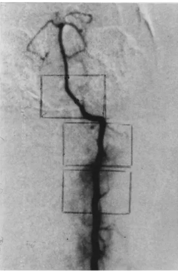 Figure 10.  Group B. Angiography of number two animal3 days after the  second SAH. 