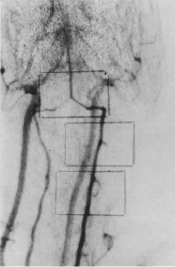 Figure  11.  Group  B.  Angiography  of  number  seven animal  before the  SAH. 