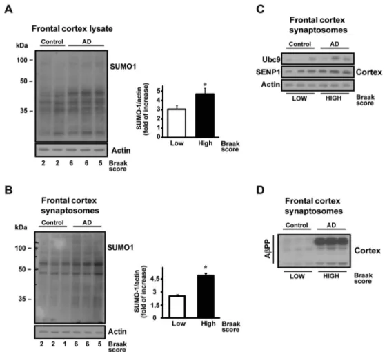 Fig. 6 SUMO-1ylation level in human AD frontal cortex lysate and synaptosomes. Western blot of SUMO-1 expression level in frontal cortex from human lysates (a) and frontal cortex