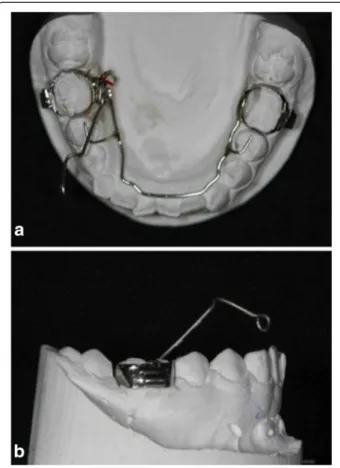 Figure 5 The orthodontic devices: the Fishing-rod. (a) Fishing- Fishing-rod in occlusal view