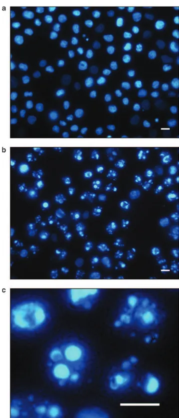 Figure 7 Fluorescence microscopy analysis of U937 cells treated with D () lentiginosine
