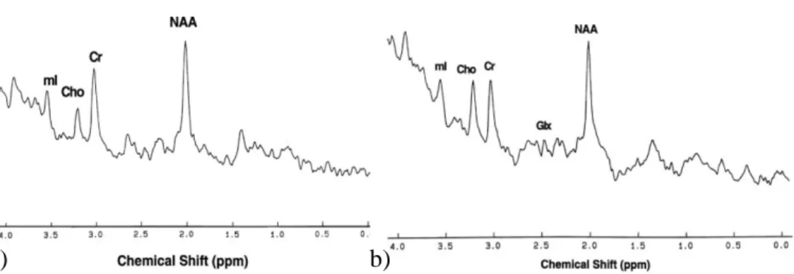 Figura  8:  Spettroscopia  single-voxel  della  sostanza  grigia  (a)  e  della  sostanza  bianca  (b)  a  livello  frontale  in  un  soggetto normale
