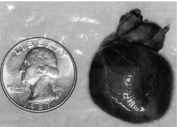 Figura 1: Cuore fetale a 20 settimane messo a confronto con una moneta  da 25 centesimi di dollaro 