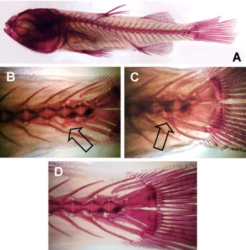 Fig. 5. Examples of some skeletal anomalies in M. cephalus. (A) Young-of-the-year without anomalies