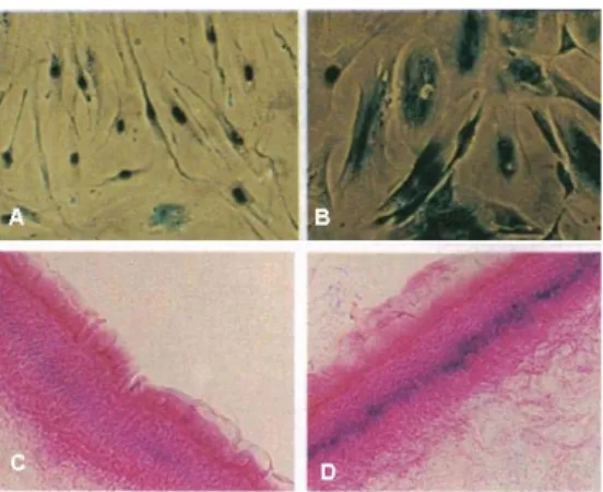 Figura 2: SA--gal in cellule umane in coltura e in sezioni di epidermide umane.  A) cellule HC2A  giovani (ingrandimento 100X); B) cellule HC2A senescenti (ingrandimento 100X); C) e D) epidermide  di una donna (C) e di un uomo (D) entrambi di 73 anni di e