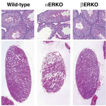 Figure 8.  Pathology of adult  ERKO and  ERKO testes. The wild-type and   ERKO  are indistinguishable,  while the  ERKO testis shows degeneration of the testicula structures