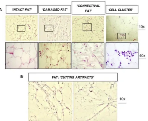 Figure 1. Histological analysis of fat graft ( ± SVF) before transplantation performed by H&amp;E staining.