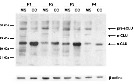 Figura 3.  Il Western Blot di estratti proteici da mucosa sana a distanza (MS) e corrispondente carcinoma  del colon (CC) di quattro pazienti (P1-P4) ha messo in evidenza l’espressione di nCLU solo nella mucosa  sana  e  una  aumentata  espressione  di  sC