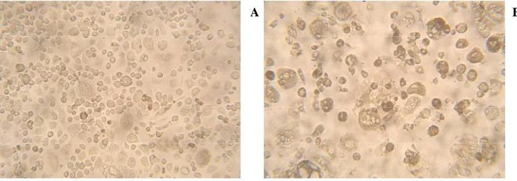 Figure 2: Light microscopic pictures of M/M after 14 days of R5 HIV-1 infection in presence (Panel A) or in  absence of DAPTA (Panel B)