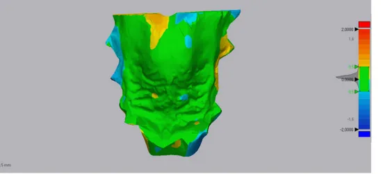 Figure 9. 3D deviation analysis between the two specular models. RGB colored scale bar (millimeters)  is reported on the right side: the top (red colored) and the bottom (blue colored) of the scale indicate  total mismatching