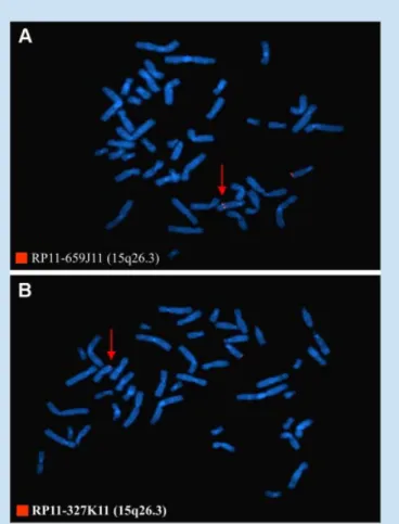 FIG. 4. FISH analysis localized the 15q breakpoint in 15q26.3, between BAC clones RP11-659J11 (not translocated) (A, arrowed) and RP11-327K11 (translocated) (B, arrowed).