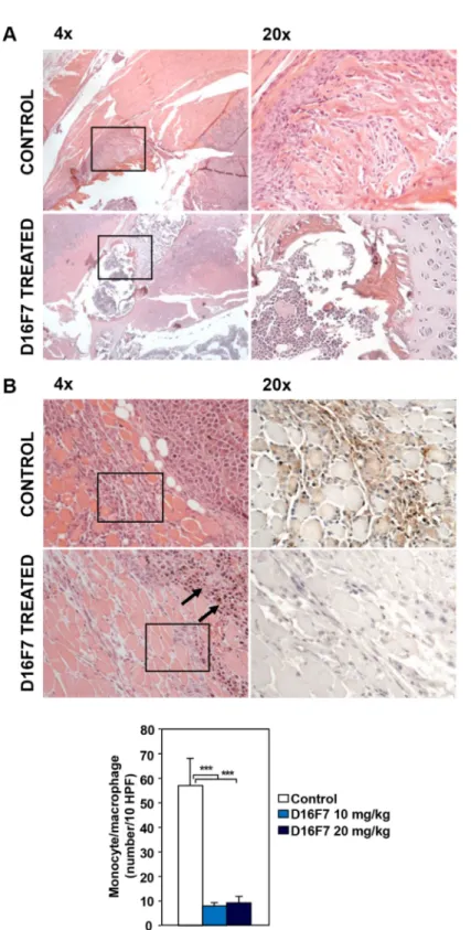 Figure 6: Treatment with D16F7 mAb inhibits bone infiltration by tumor cells and monocyte/macrophage infiltration  at the tumor border
